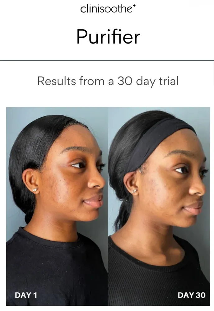 Clinisoothe+ Skin Purifyer 250 ml