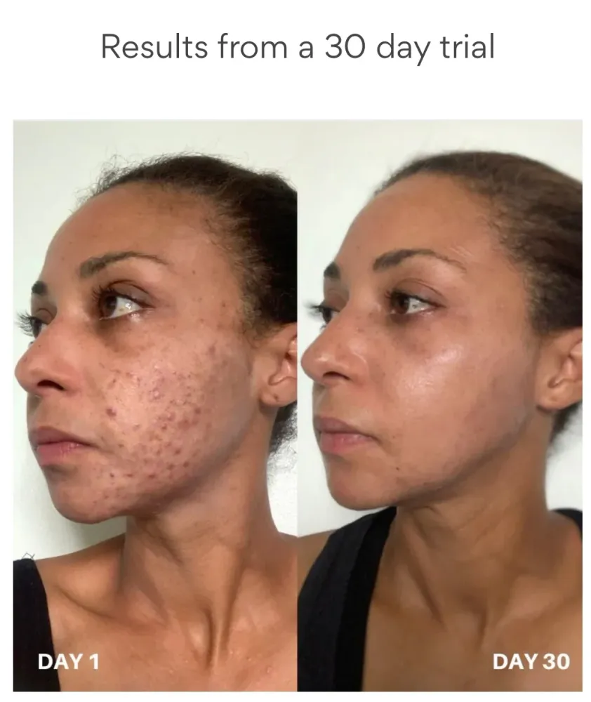 Clinisoothe+ Skin Purifyer 250 ml