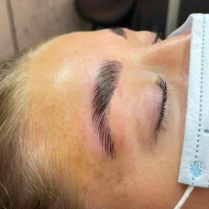 Lasernivå Come on over Browlift